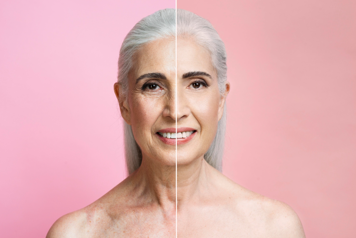 Beneficios de la mesoterapia facial con vitaminas - Palmamédica
